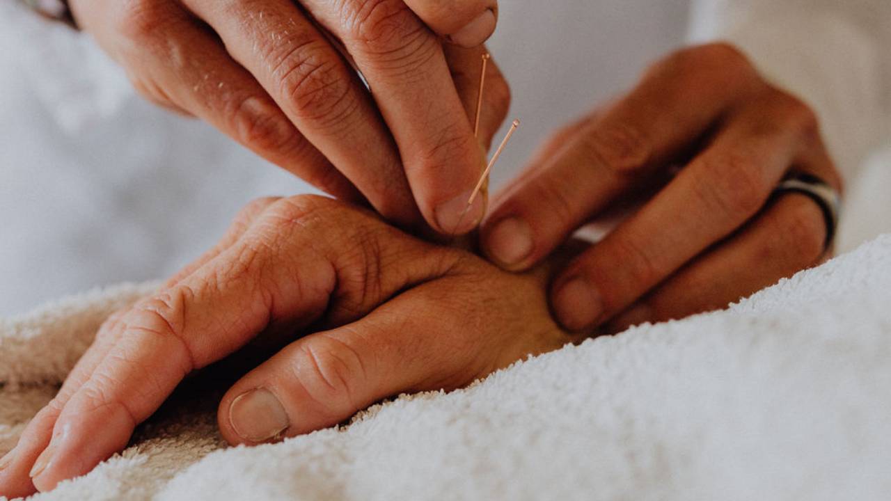 Angela Chambers, acupuncturist, inserting acupuncture needles into hand