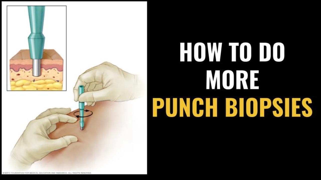 002 How to do more punch biopsies in your practice