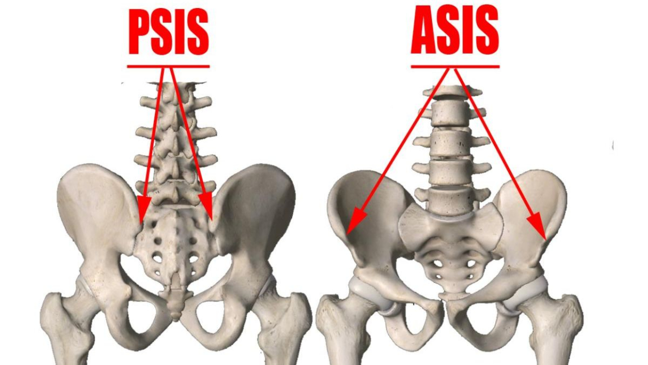 Ustawienie ciała w staniu z widoczną miednicą i nogami jako wprowadzenie do tematu zablokowanego stawu krzyżowo-biodrowego.