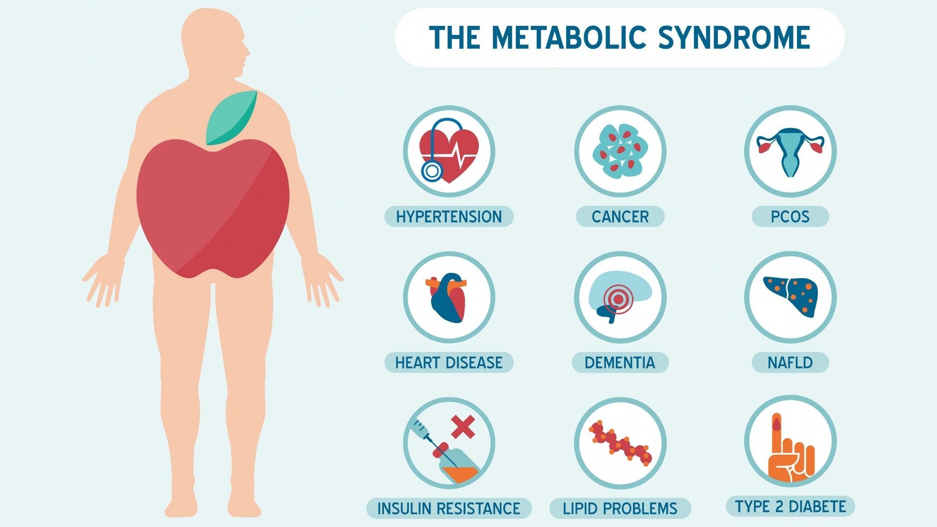 Visual representation of metabolic syndrome's impact on the body