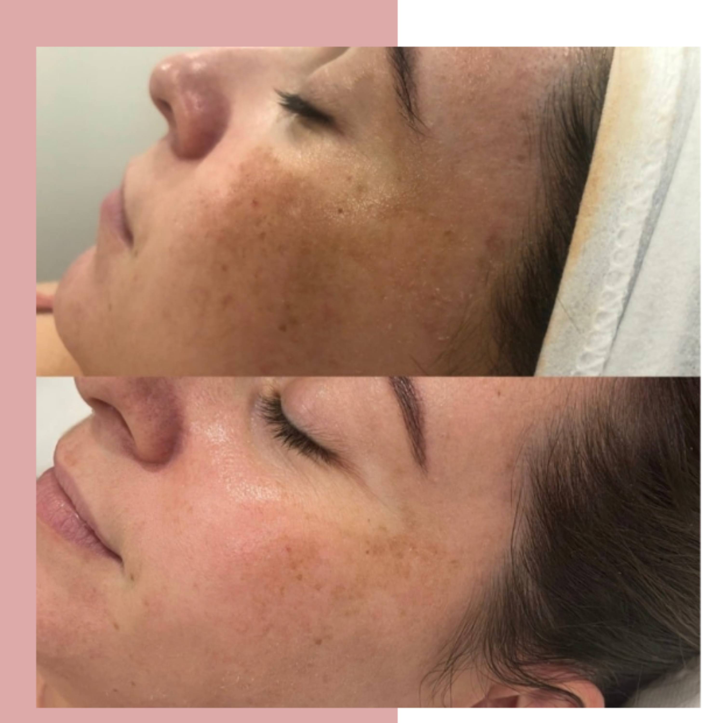 Pigmentation - how it actually works