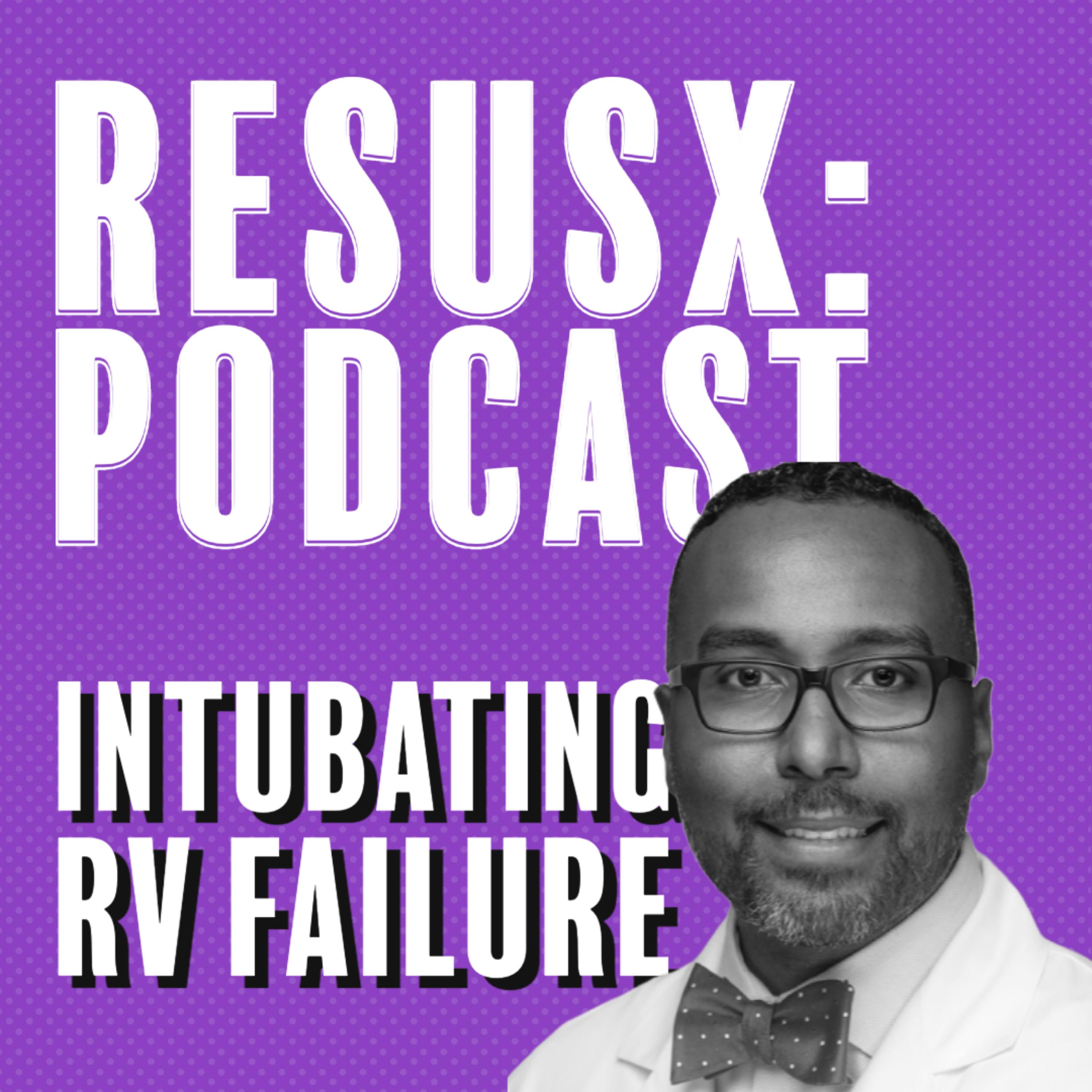 Intubating RV Failure