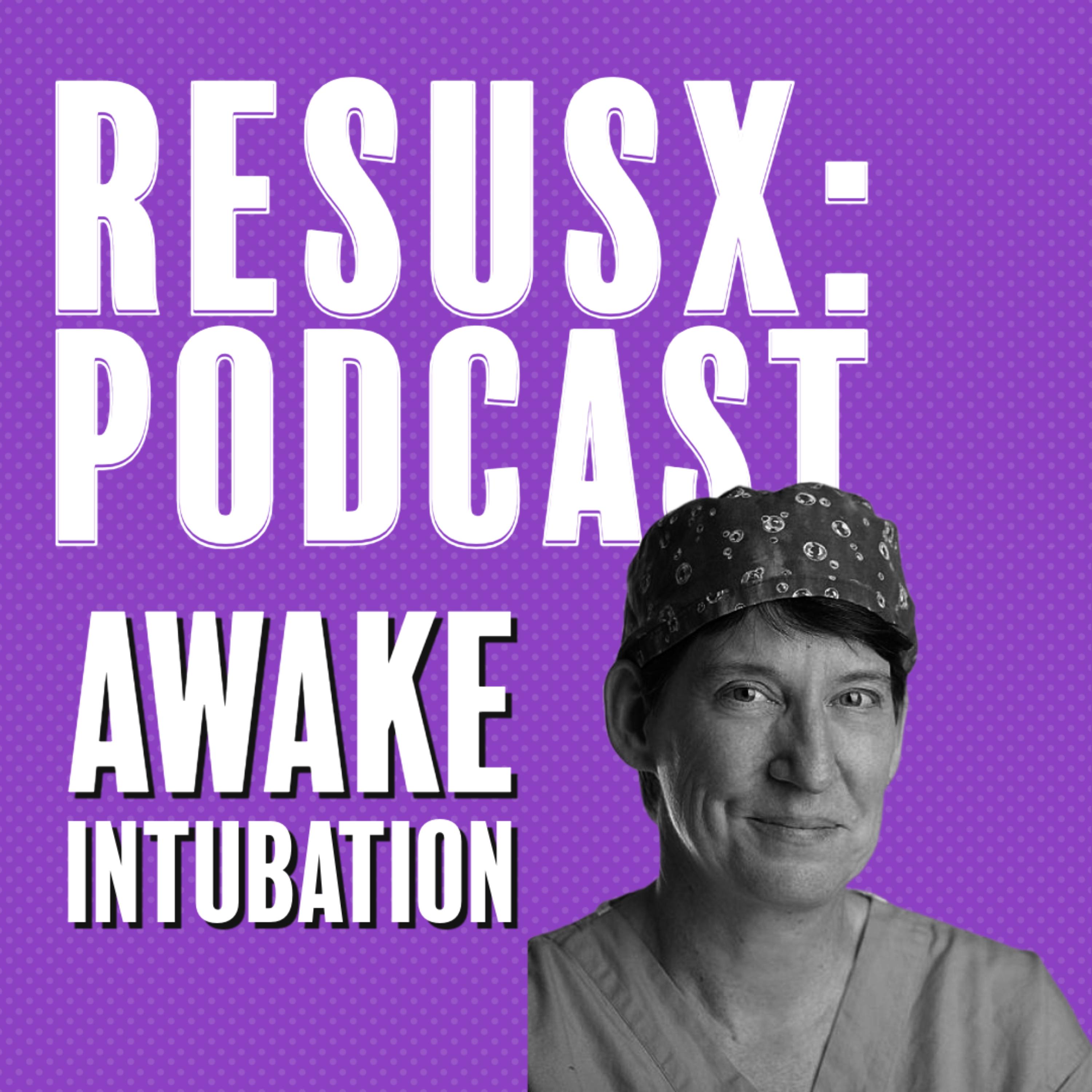 Awake Intubation