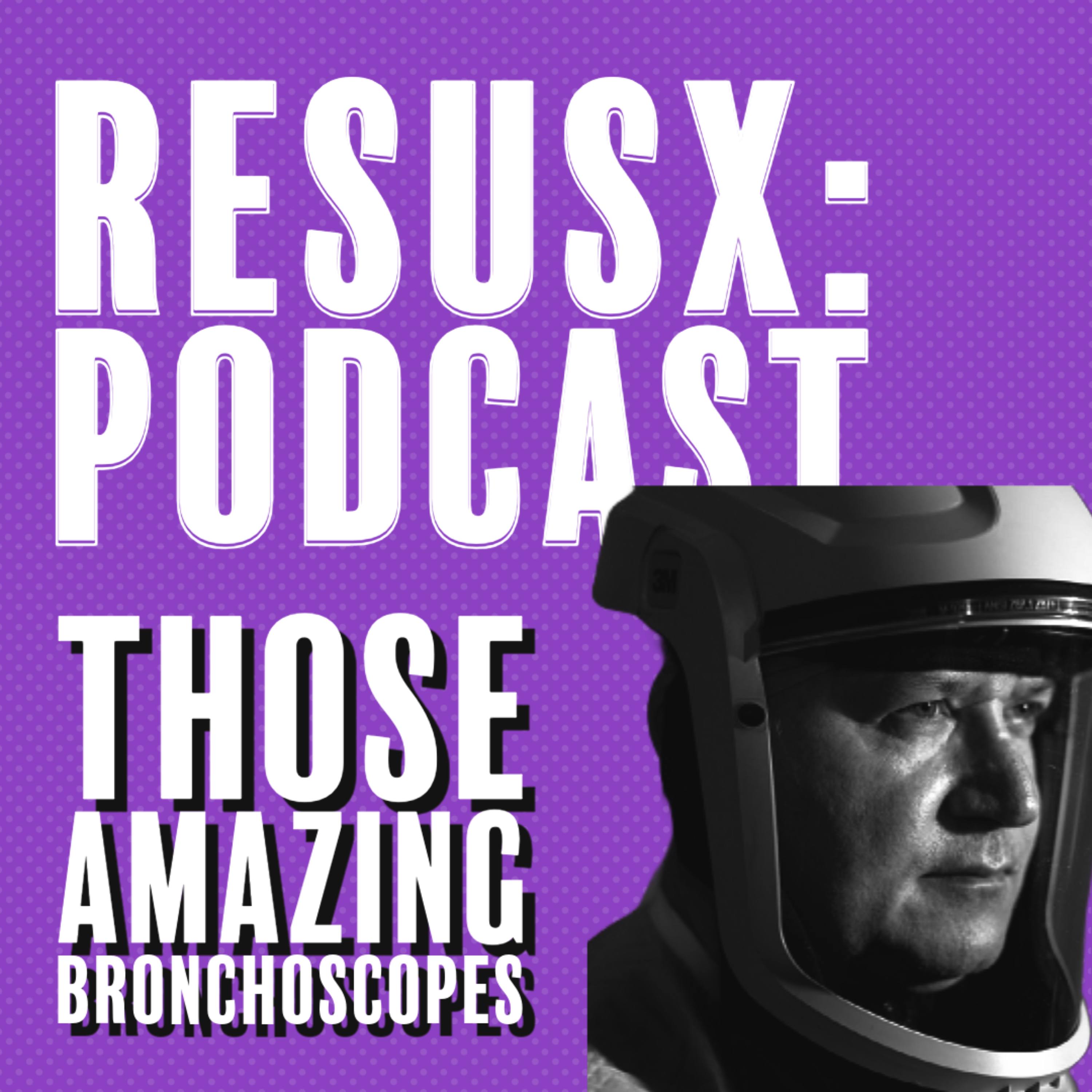 Those Amazing Bronchoscopes