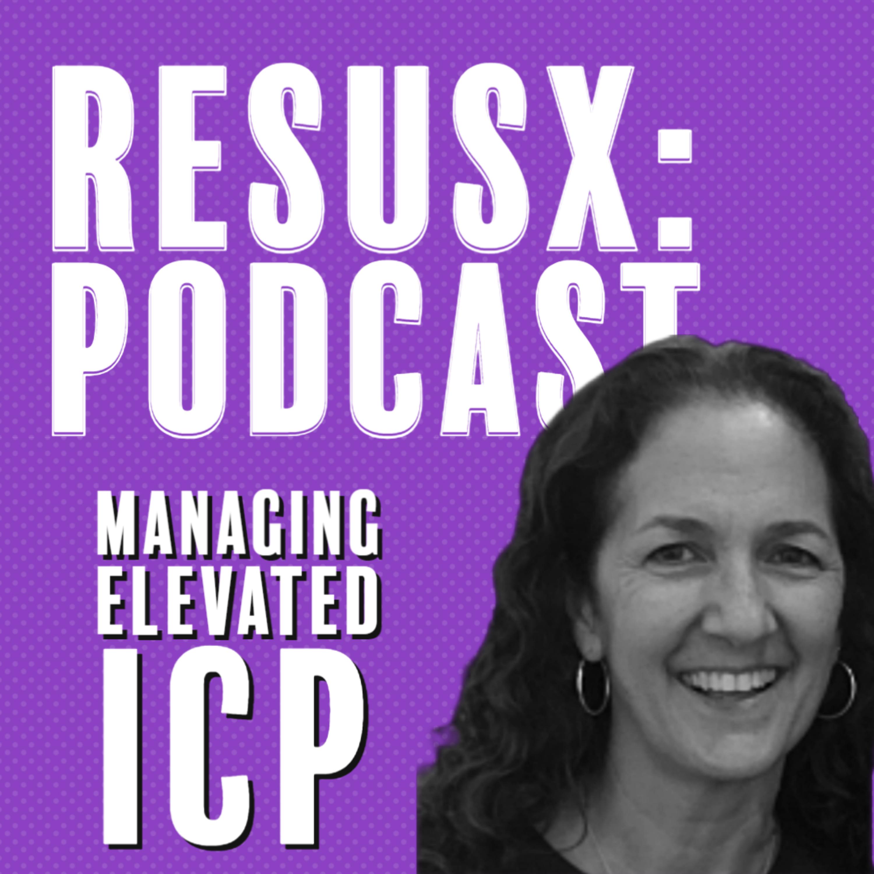 Managing ICP