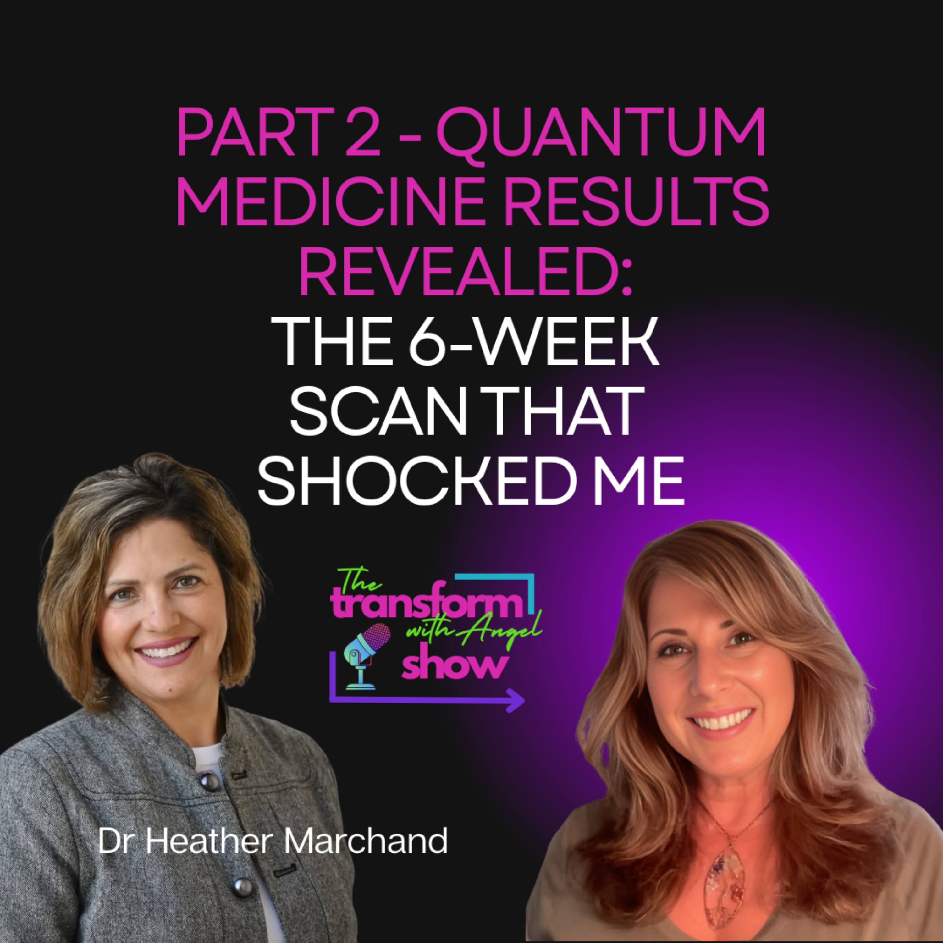 The Transform with Angel Show