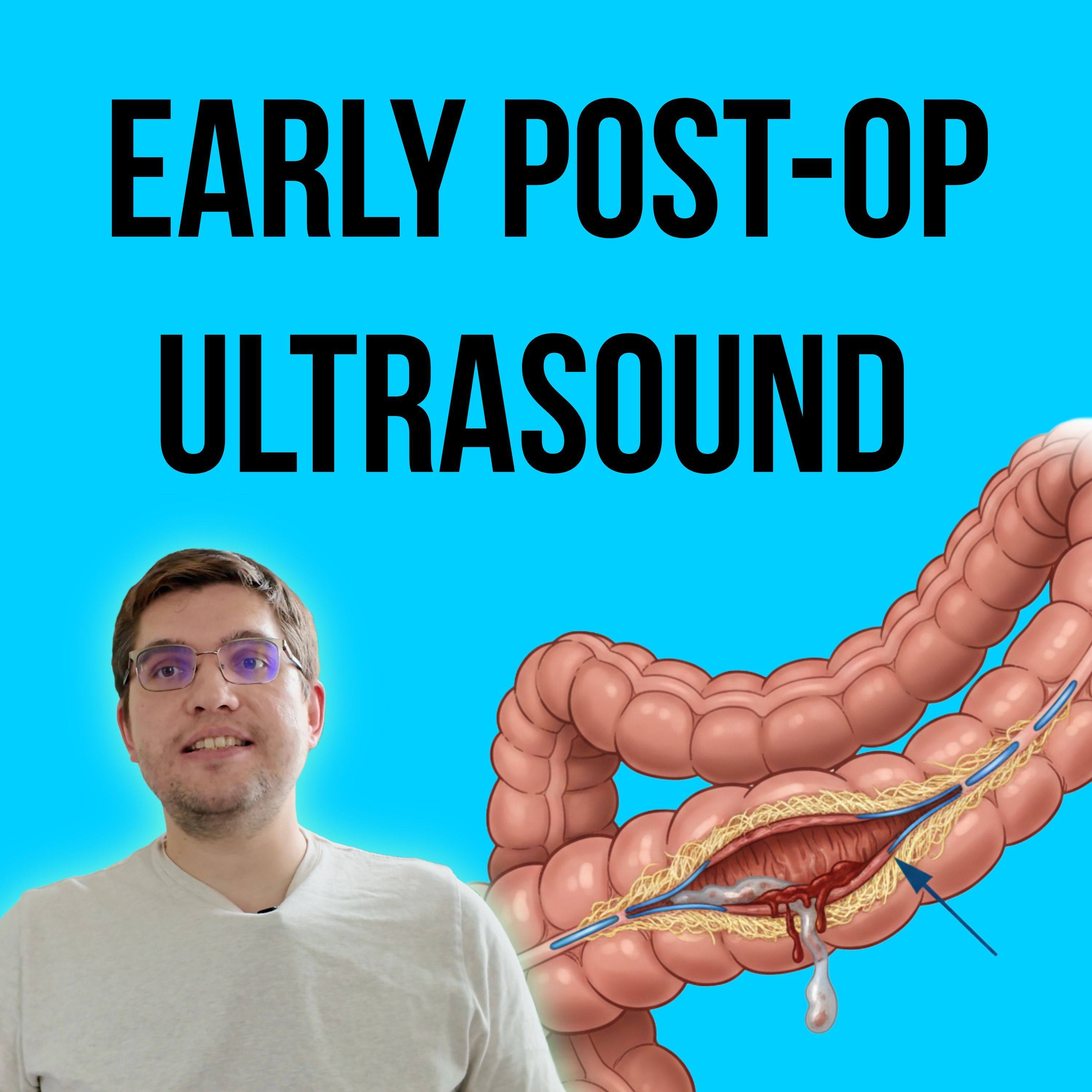 Episode 11: Early Post-Op Ultrasound After Intestinal Surgery episode artwork
