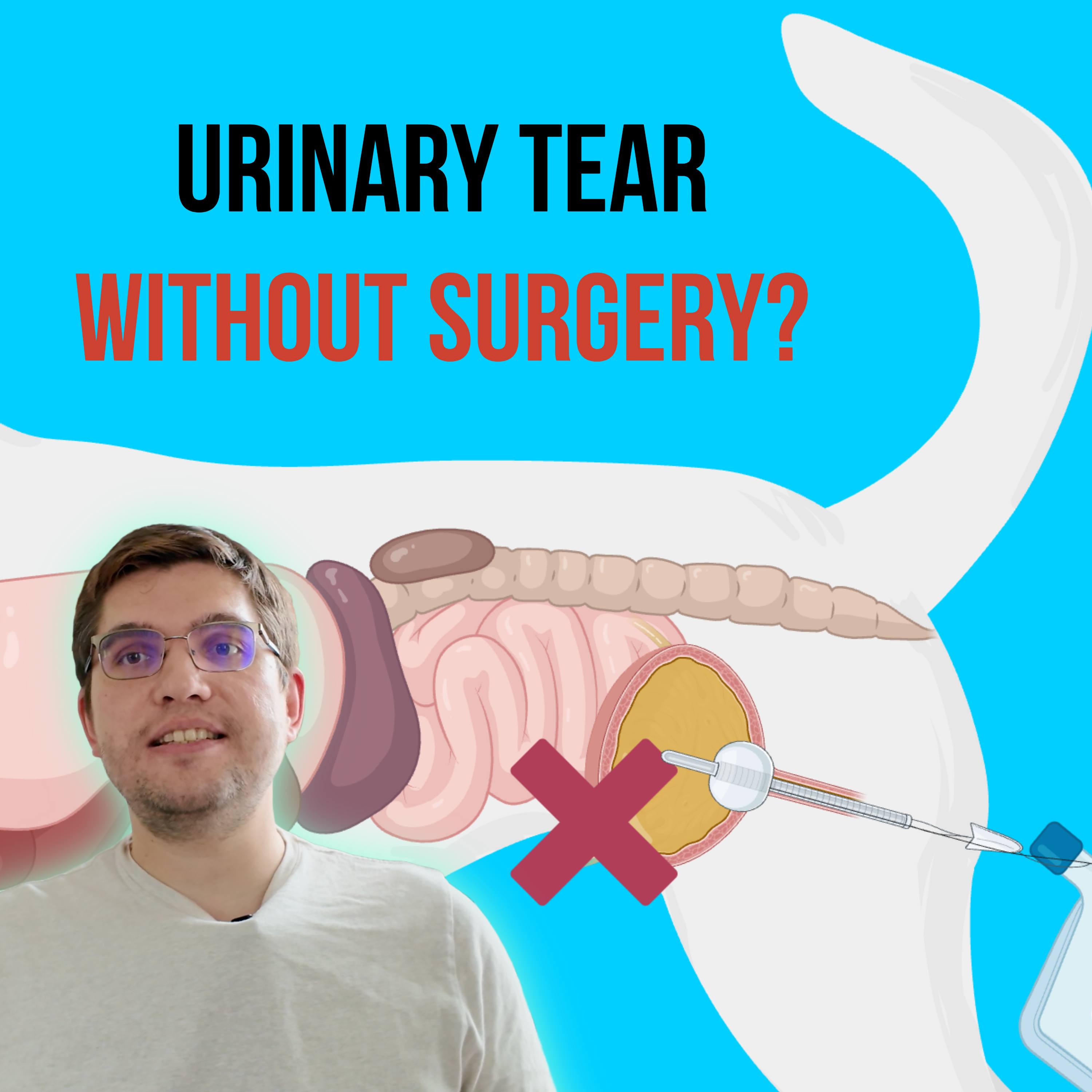 Episode 5: Managing Urinary Tract Tears Without Surgery episode artwork