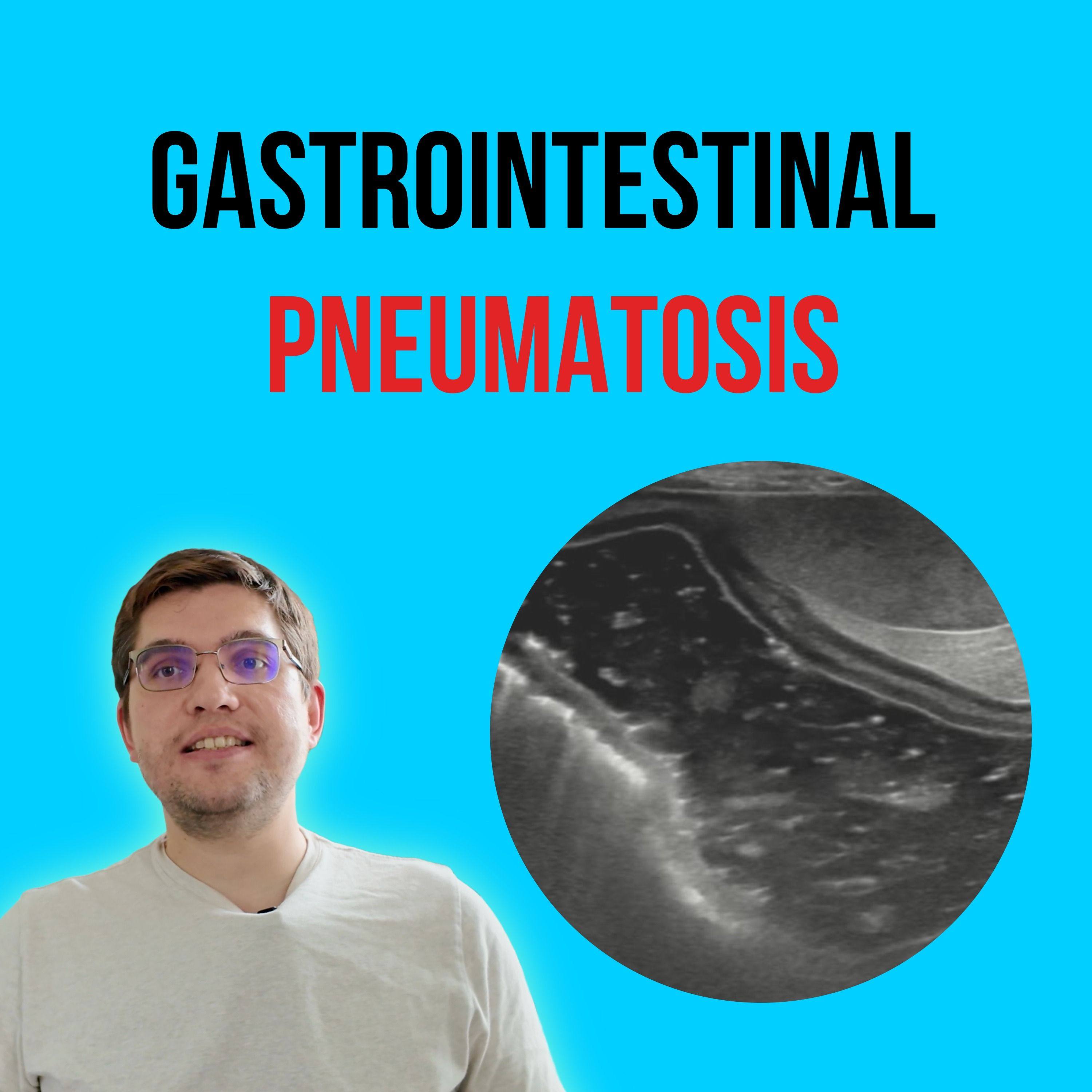 Episode 8: Gastrointestinal Pneumatosis episode artwork