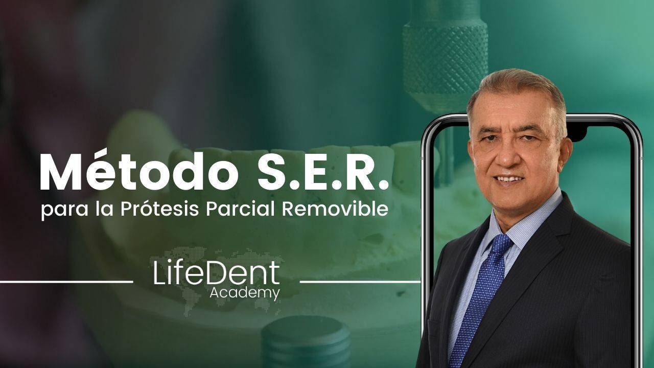Método S.E.R. para PPR