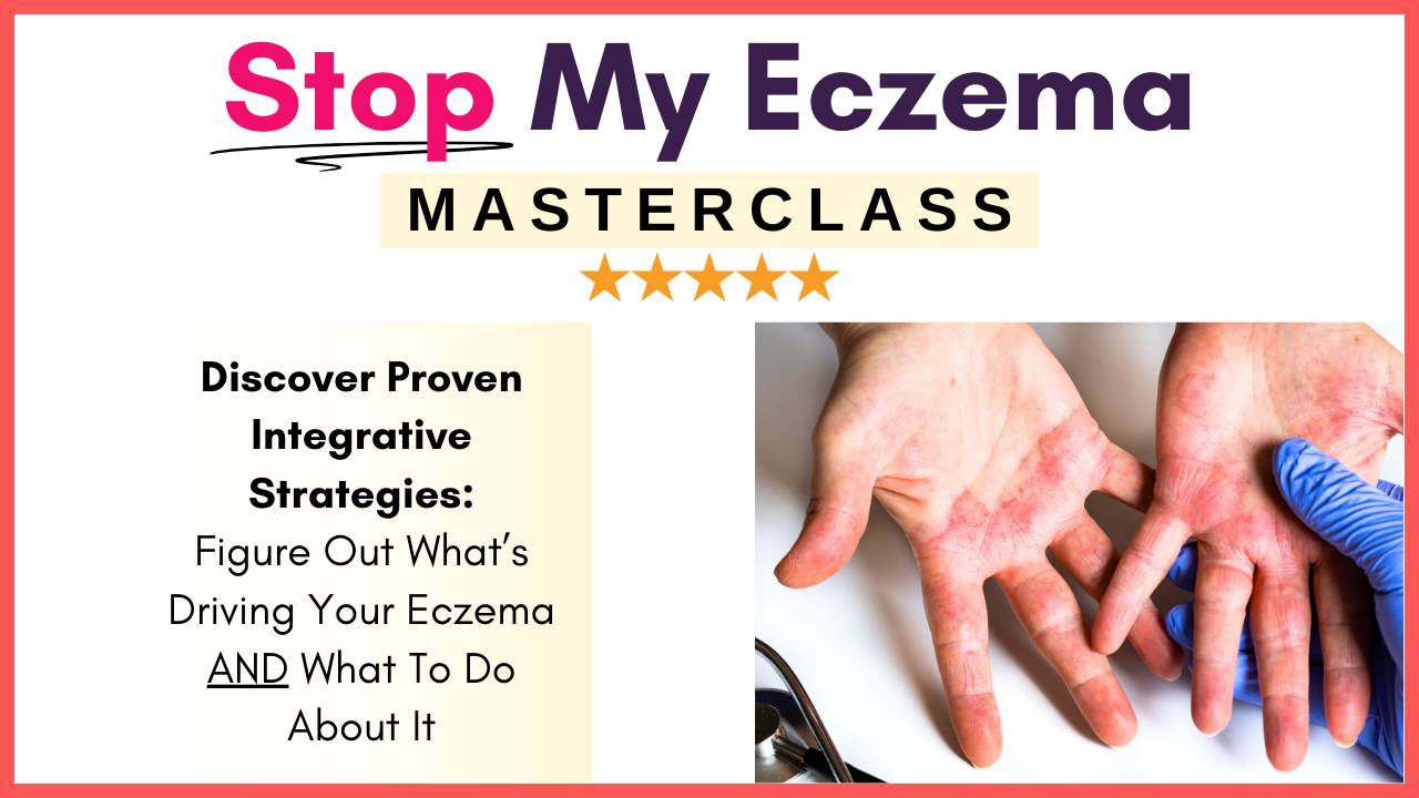 Stop My Eczema Masterclass cover