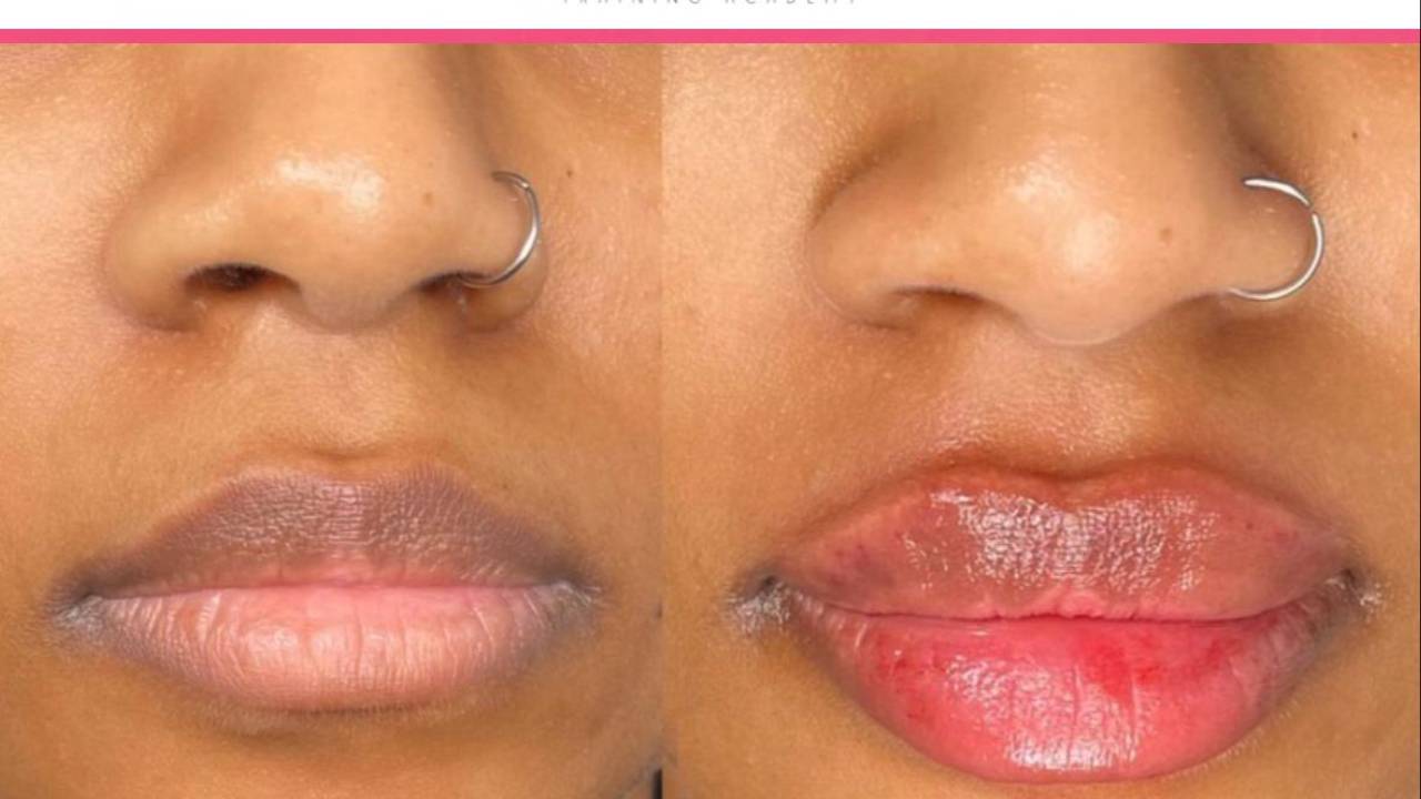 Russian Lip Technique