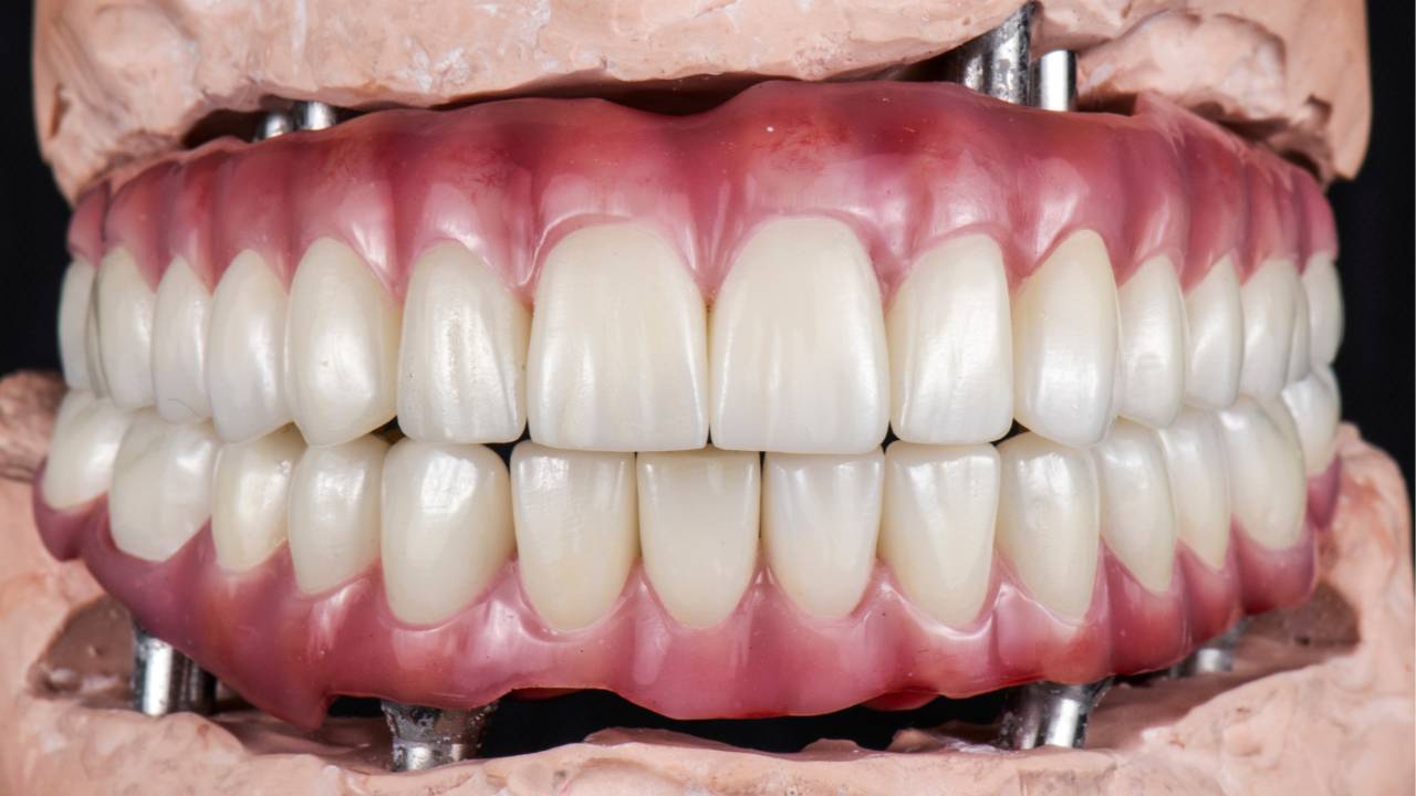 Introduction to Occlusion in Restorative Dentistry Dr. Darin Dichter