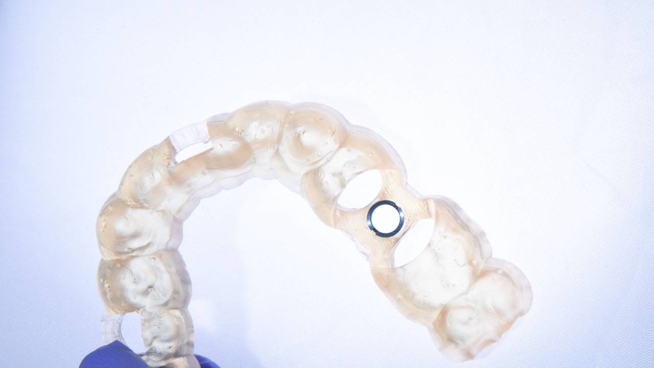 Foundation in Implants with Dr. Ivan Chicchon