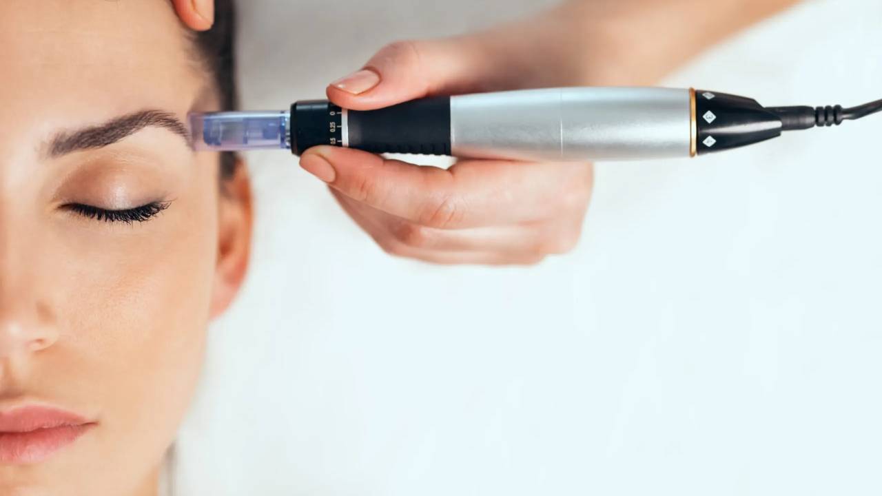 Microneedling on Eyes and Lips