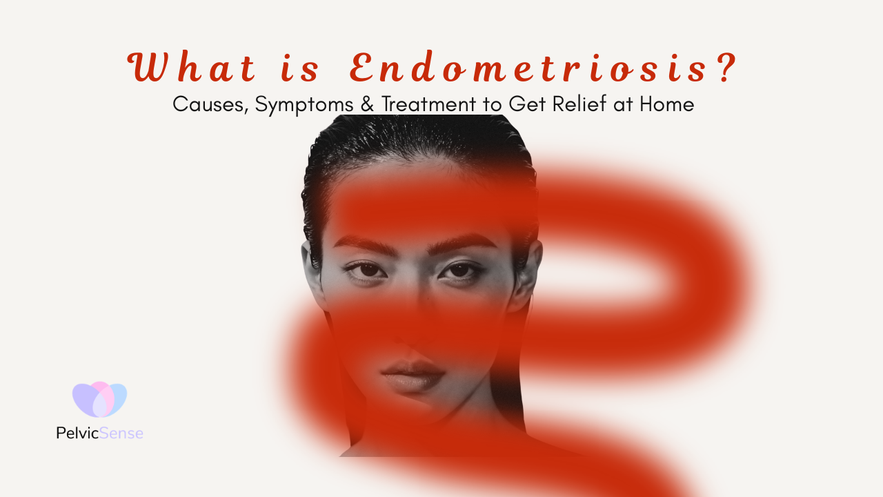 What Is Endometriosis
