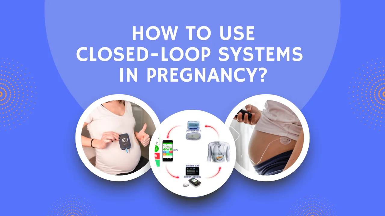 How to Use Closed-Loop Systems in Pregnancy?