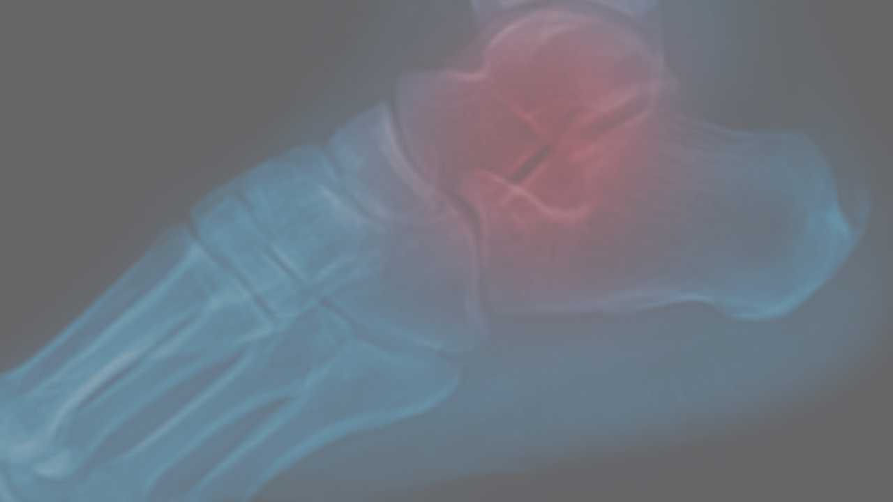 The Vital Ankle and Foot Complex course artwork