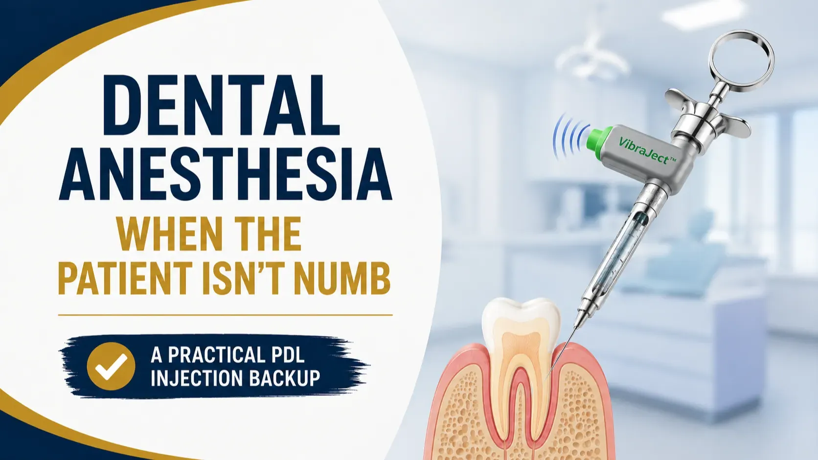 Dental anesthesia graphic showing a PDL syringe and backup injection technique for a patient who is not numb