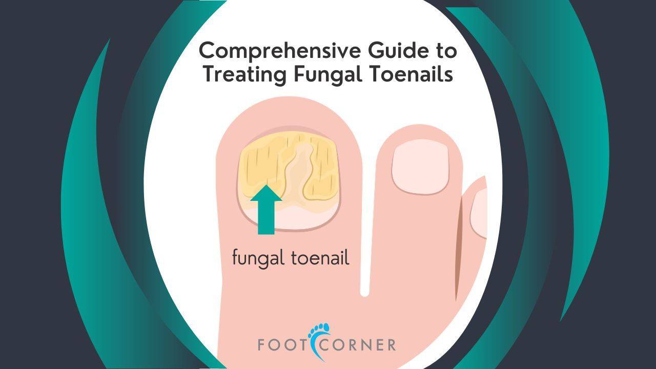 Comprehensive Guide to Treating Fungal Toenails - Treating Fungal Toenail Infections In Children