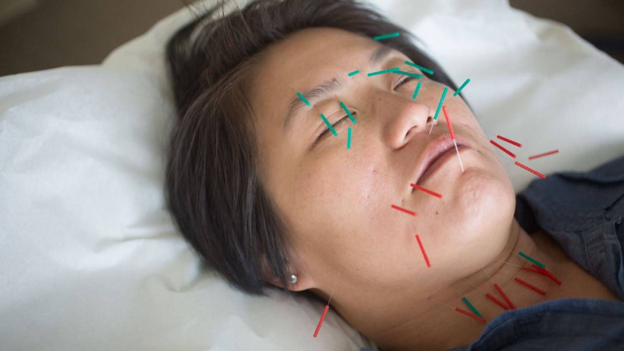 Cosmetic Acupuncture before a Big Event: Your Natural Glow-Up Timeline