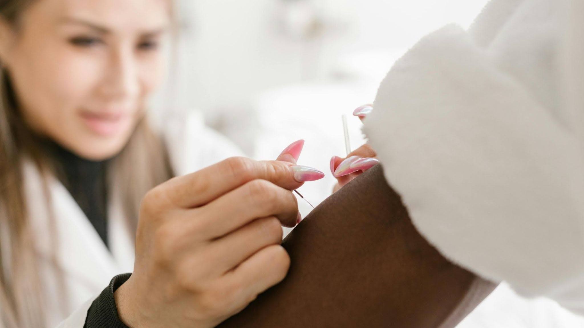 Microneedling Acupuncture