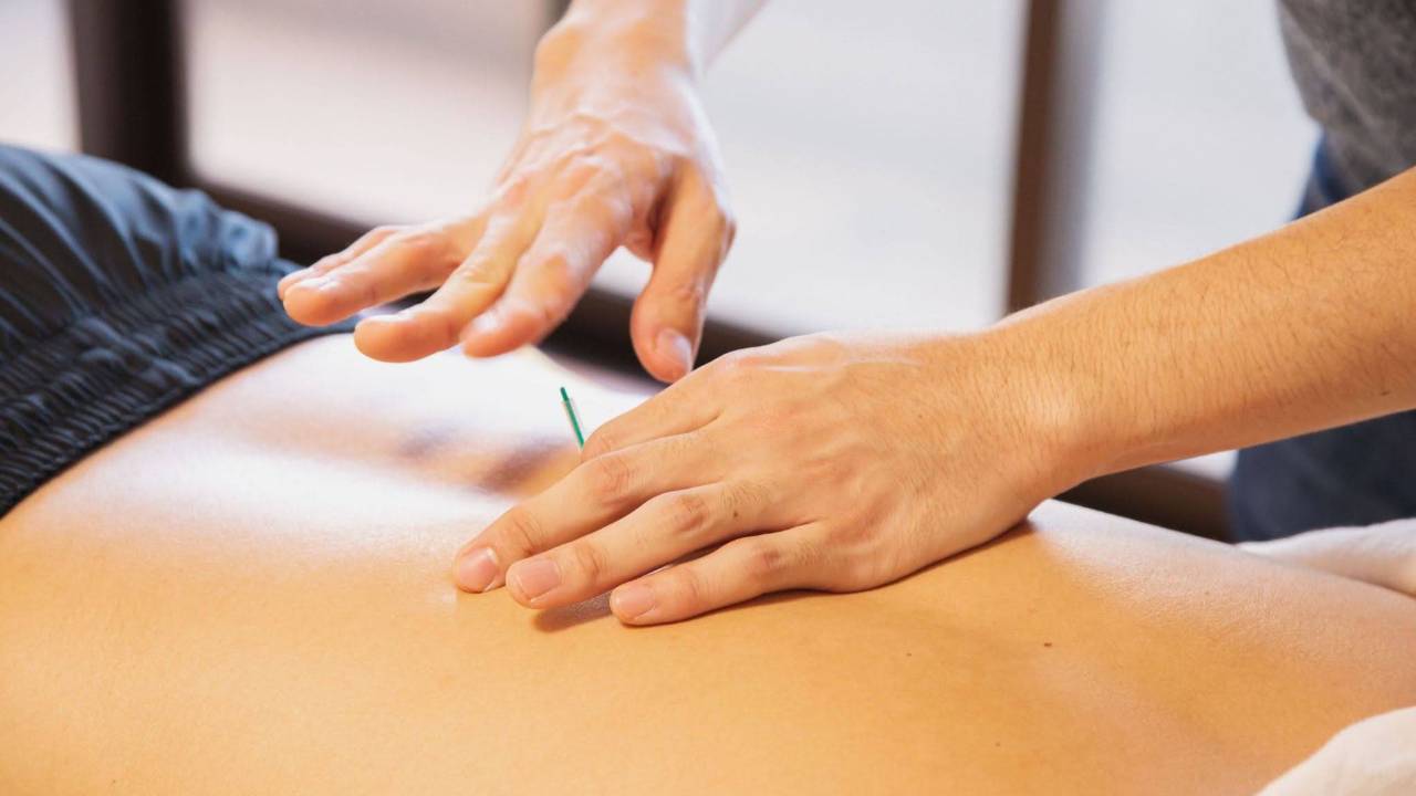 5 Myths about Orthopedic Acupuncture Oakland Patients Still Believe
