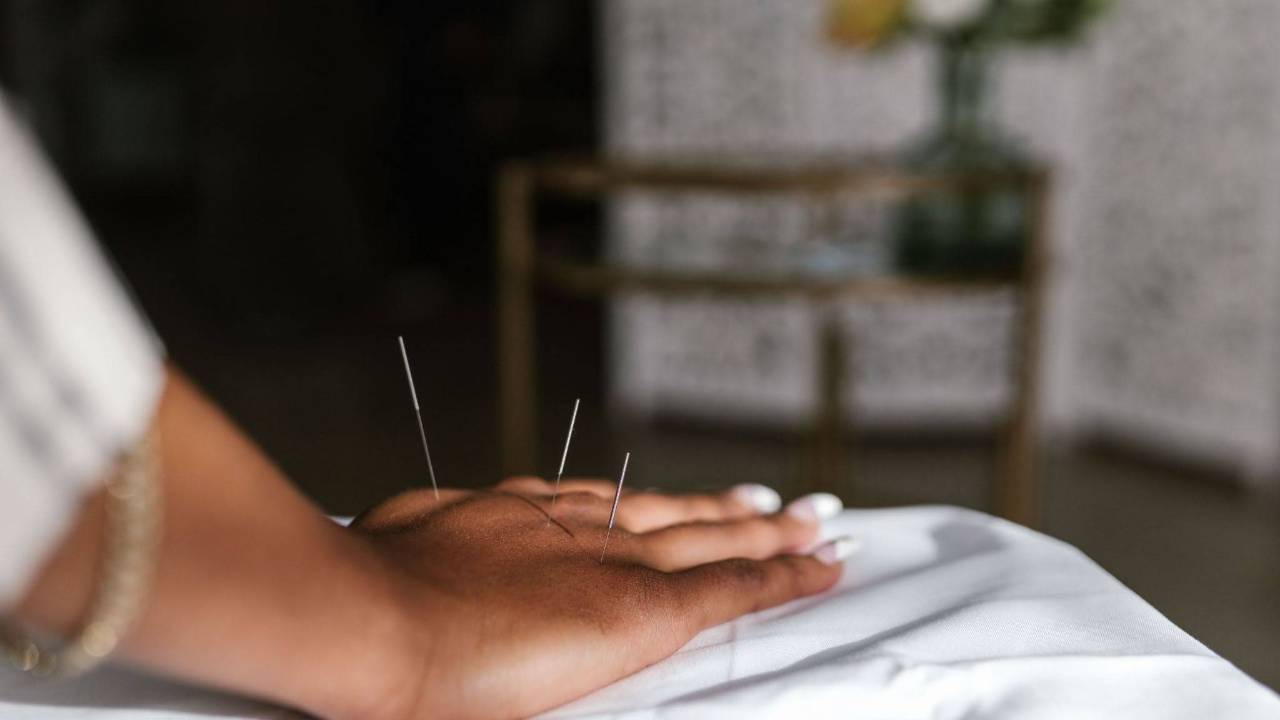 Private vs. Community Acupuncture in Oakland: Which Setting Fits Your Healing Goals?