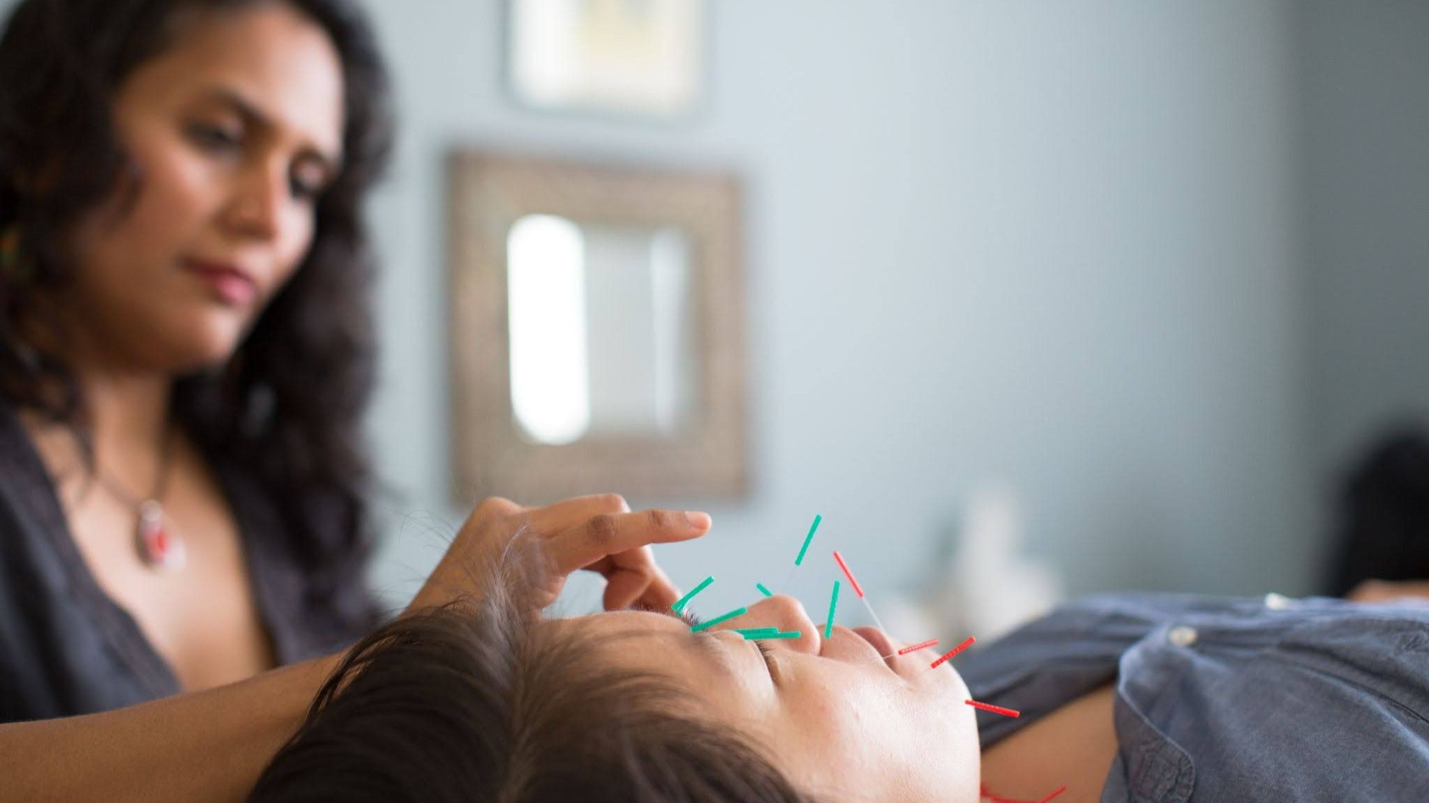 Facial Acupuncture