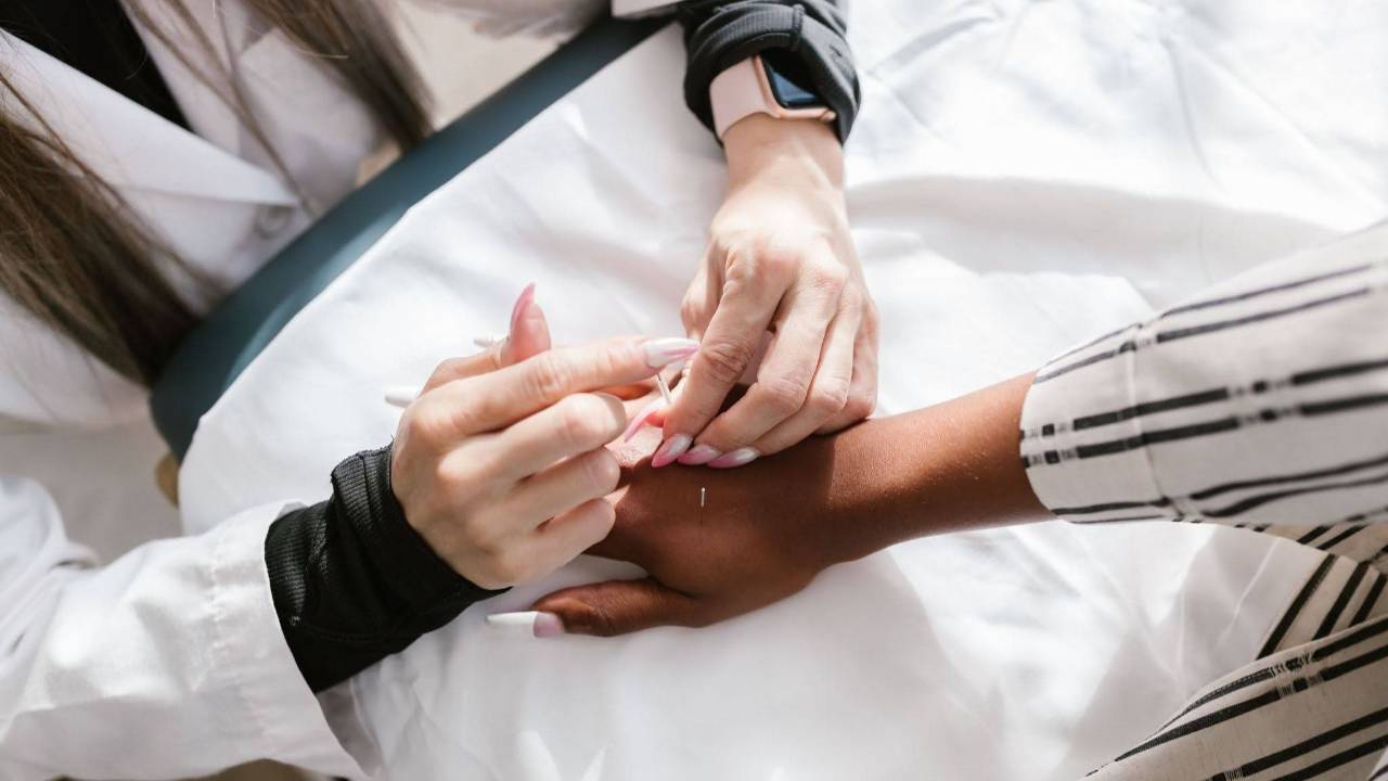 Microneedling Acupuncture Aftercare: Top 5 Tips for Faster Healing and Better Results