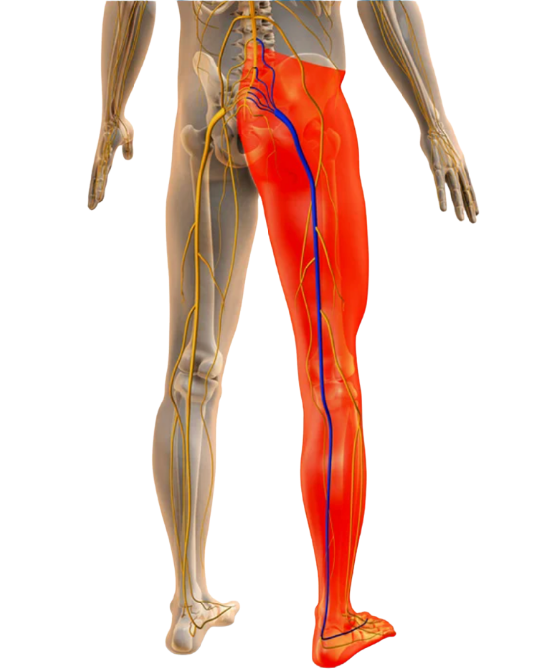 what is sciatica?