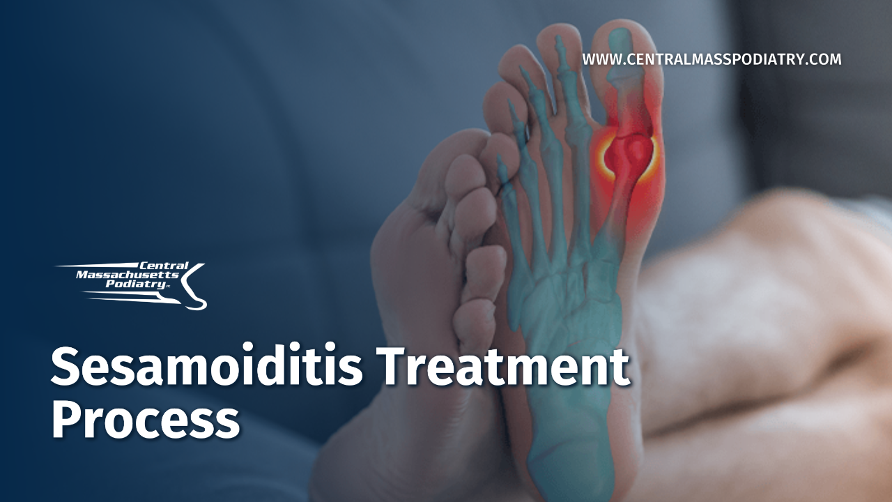 Sesamoiditis Treatment Process