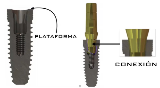 Plataforma y conexión del implante