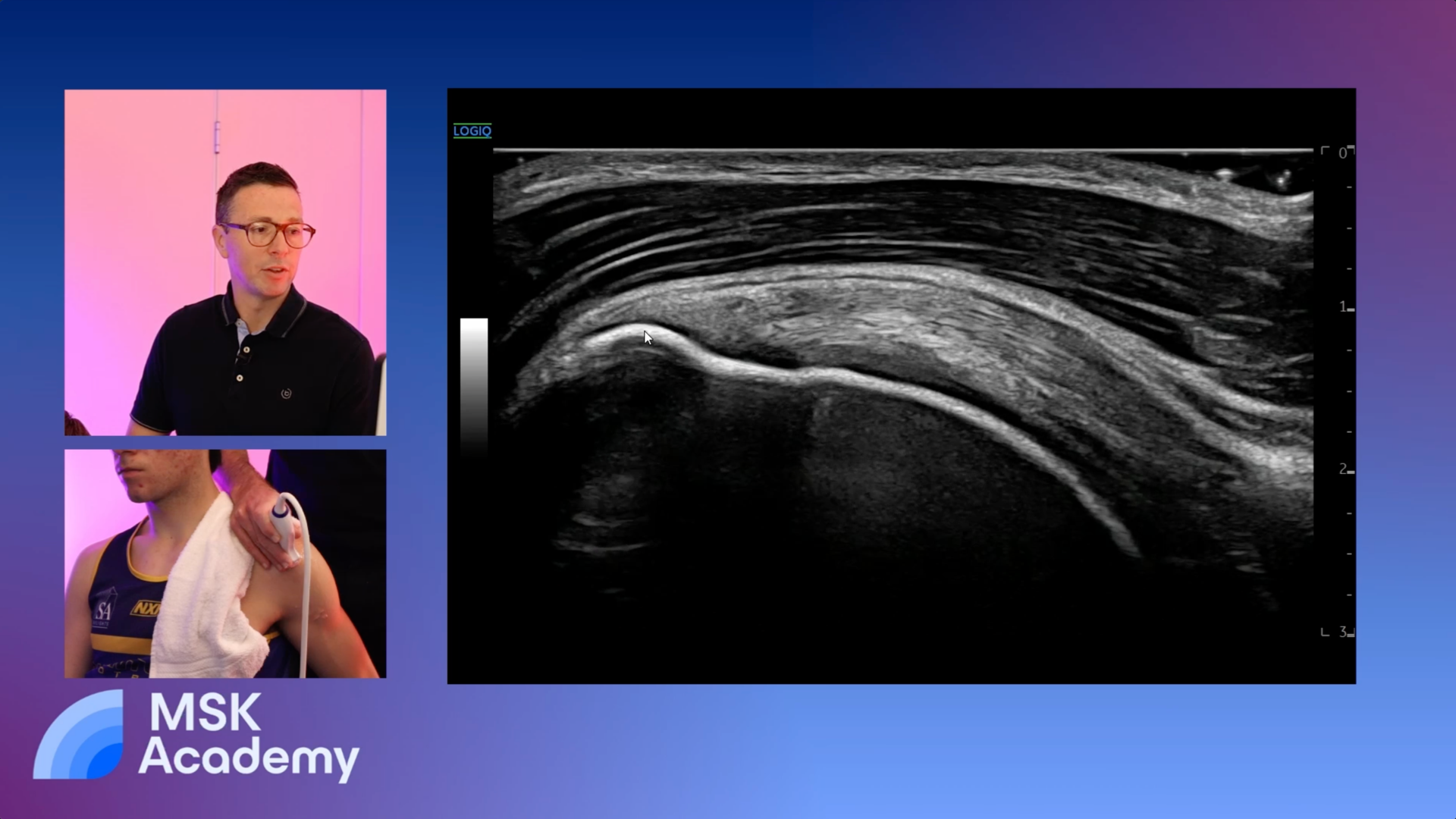Shoulder Scanning