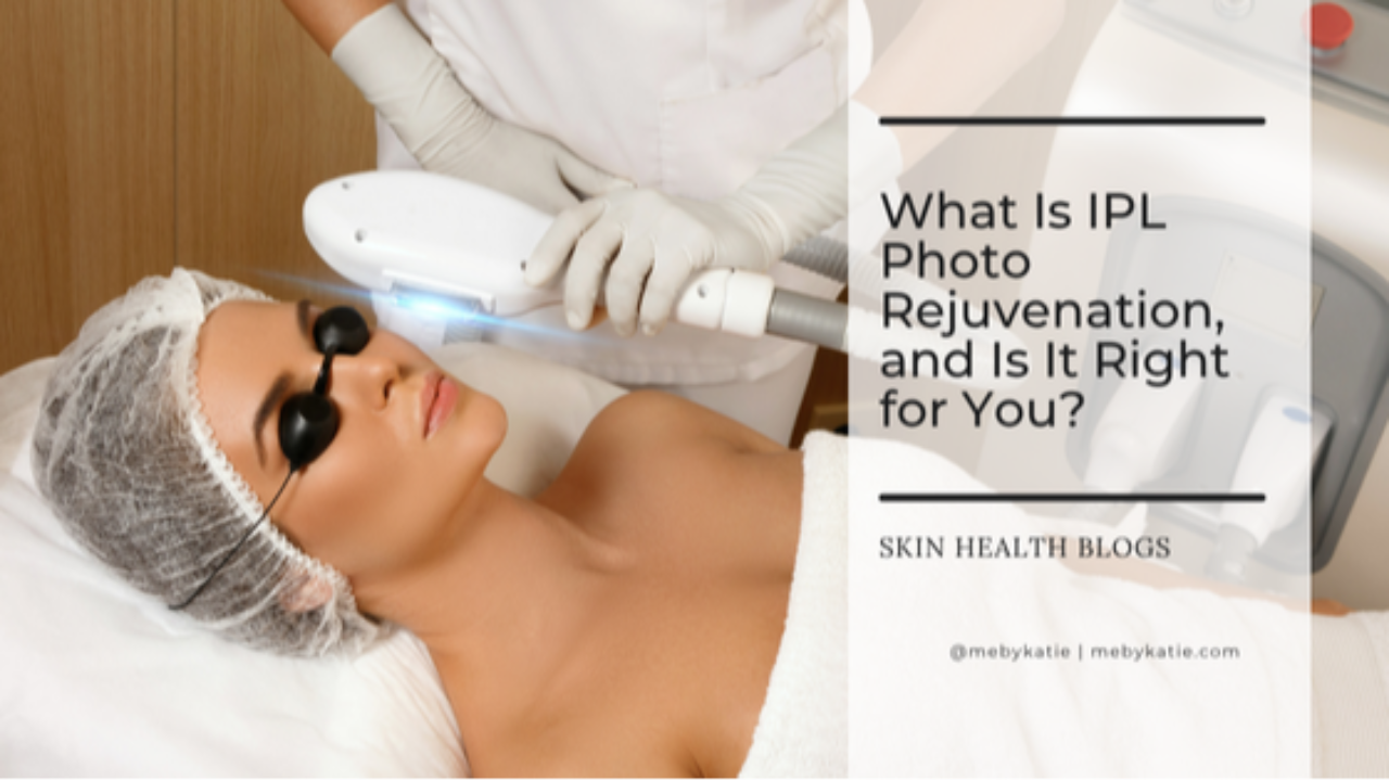 What Is IPL Photo Rejuvenation? @mebykatie