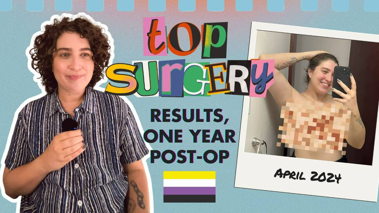 Nonbinary Top Surgery One Year Post Op (NO NIPS)