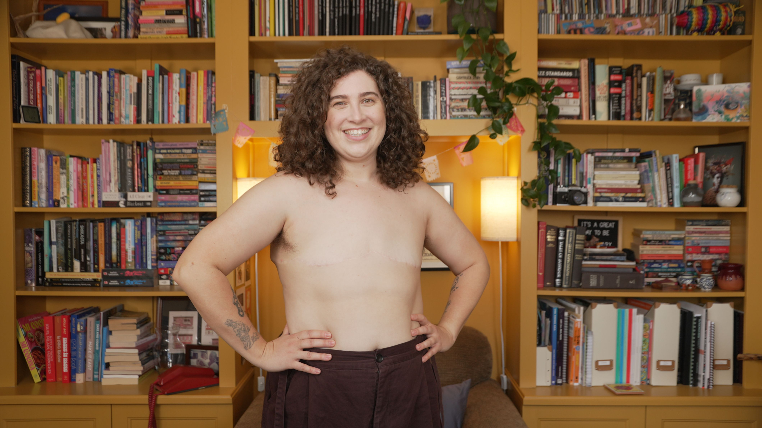 Nonbinary person, Ren&eacute;e Yoxon, with their shirt off, showing off their nonbinary post-top surgery chest. Double incision with no nipples.