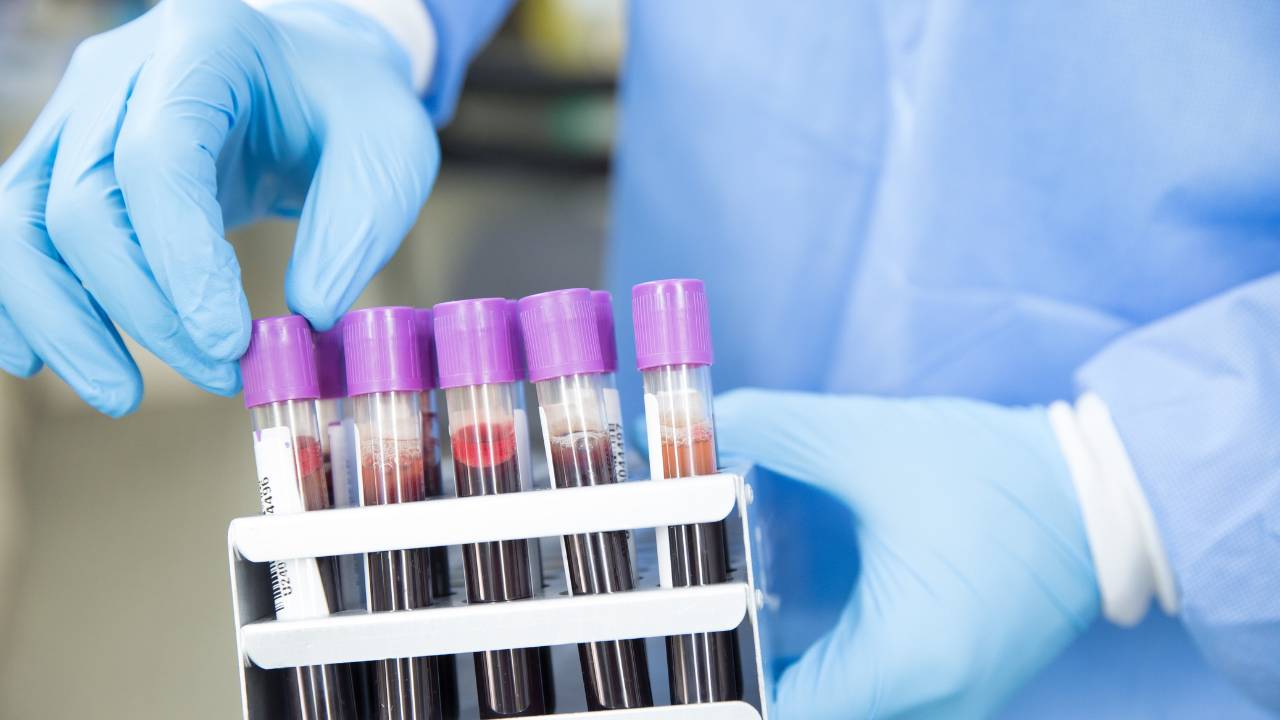 Which labs to order, and why?