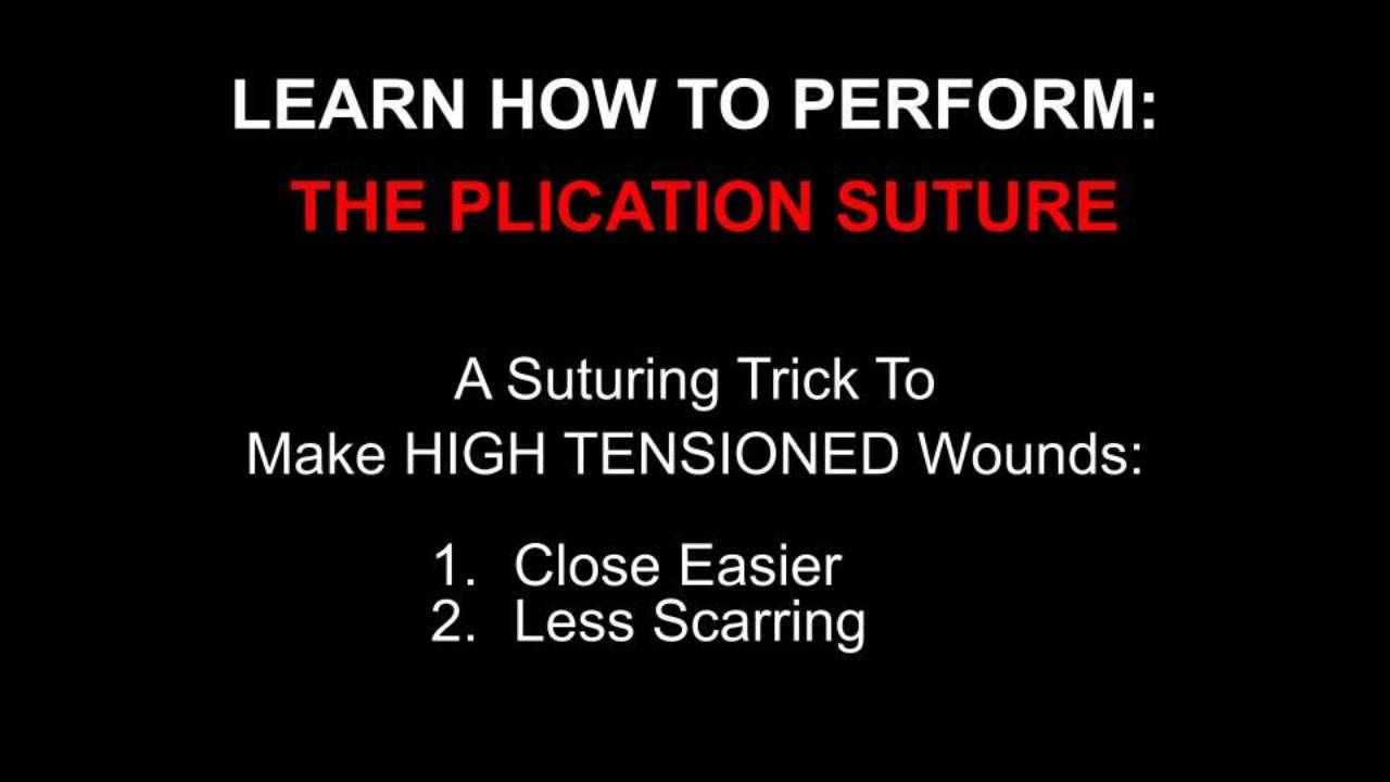 What Is A Suture Plication? – SMAS Plication Facelift – GXXKE
