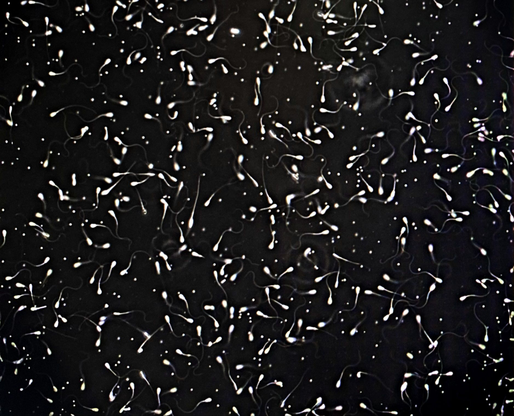 Microscope image of healthy Dexter bull sperm sample from Marvel at Mountain Heritage Farm