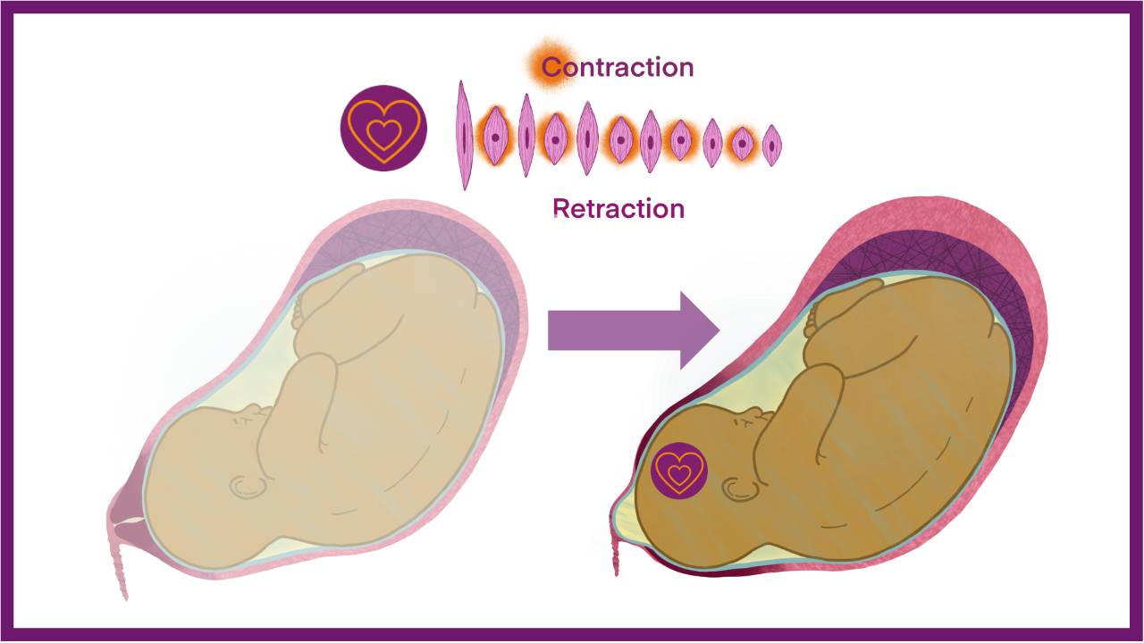 The Effective Labour Contraction
