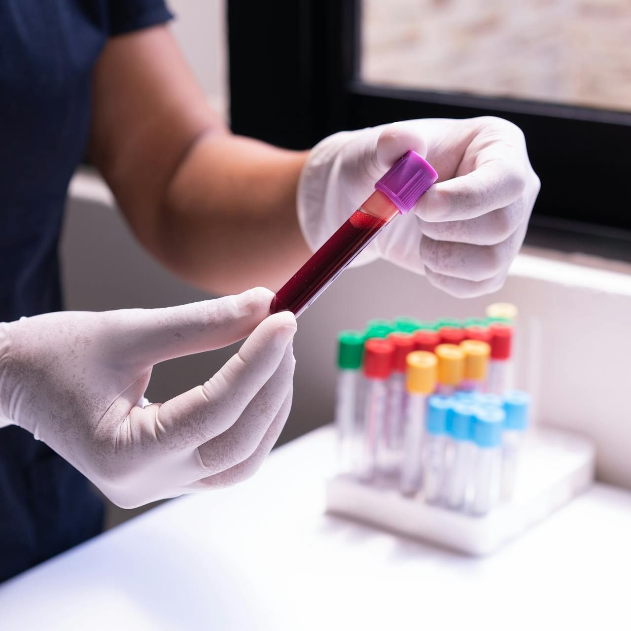 Photo of vials for blood draw