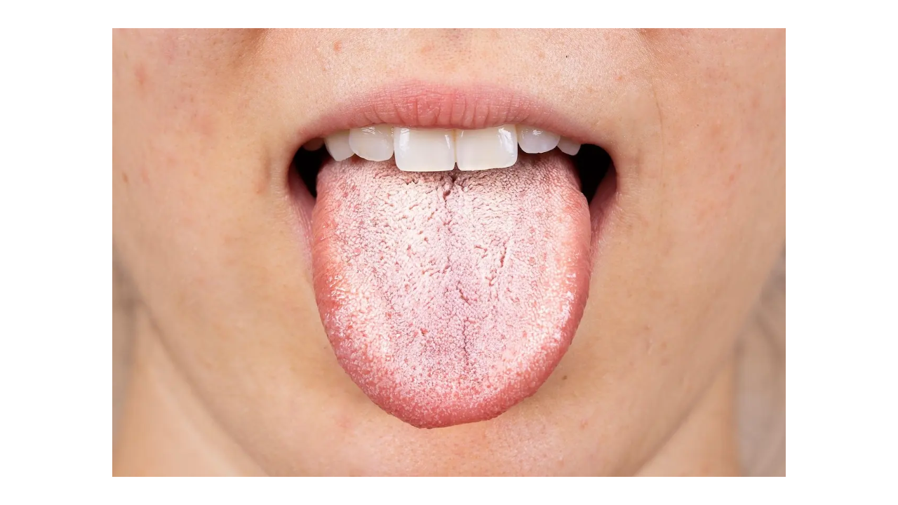 Why Does My Mouth Taste Like Mold? Causes & Fixes