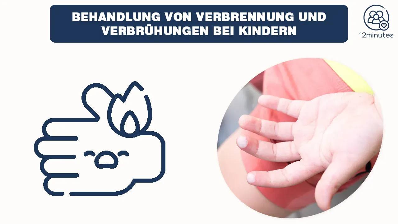 Verbrennungen und Verbrühungen bei Kindern behandeln