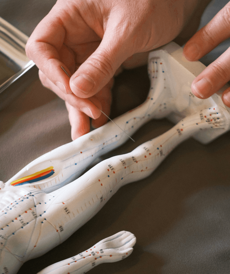 Acupuncture and holistic healing treatment