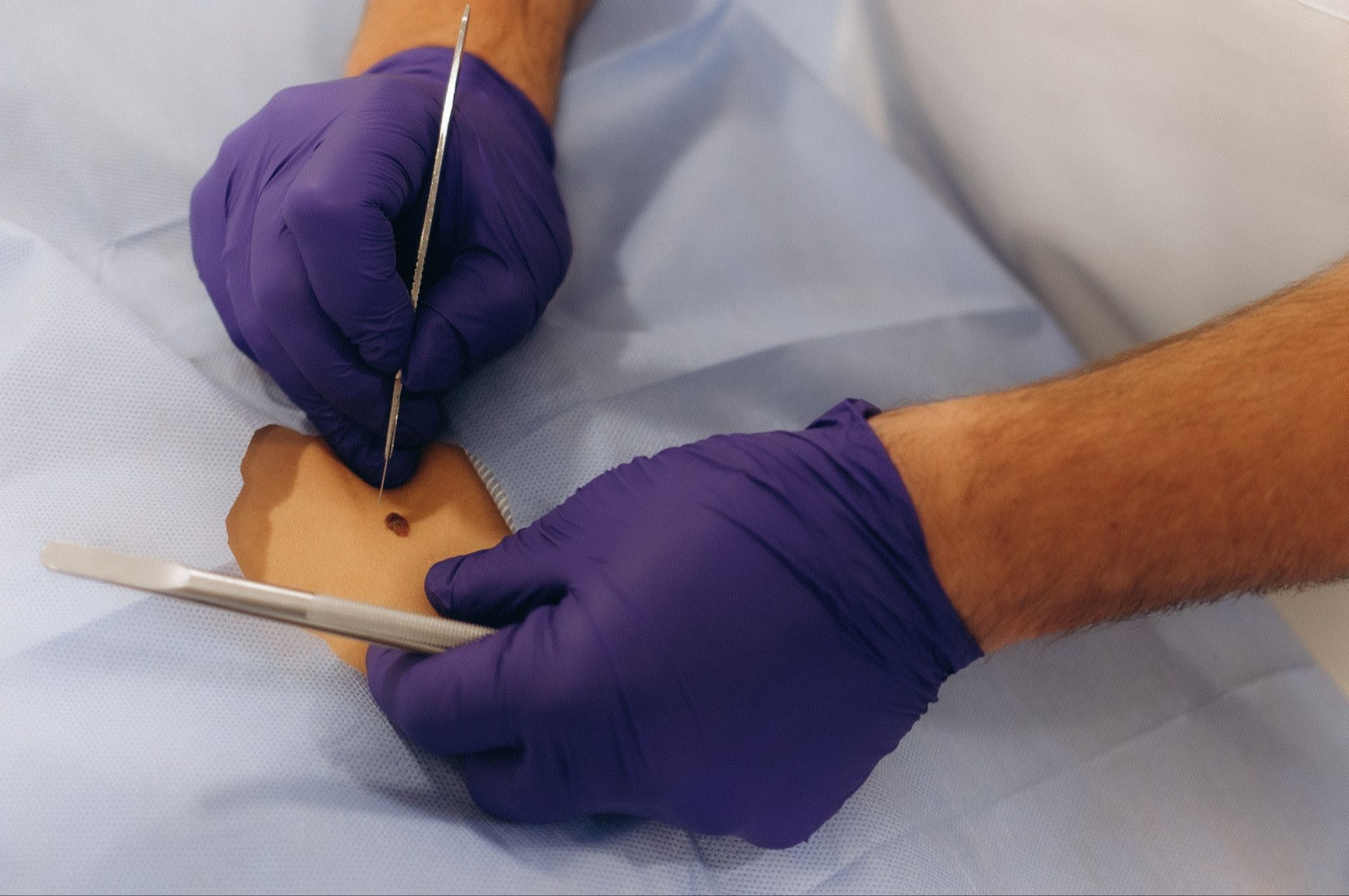 Professional Certificate of Advanced Skin Cancer Medicine and Surgery