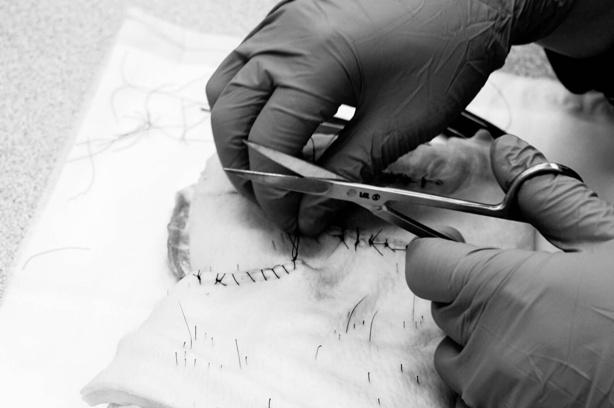 Certificate of Advanced Skin Cancer Medicine and Surgery - Part 2 (Practical)