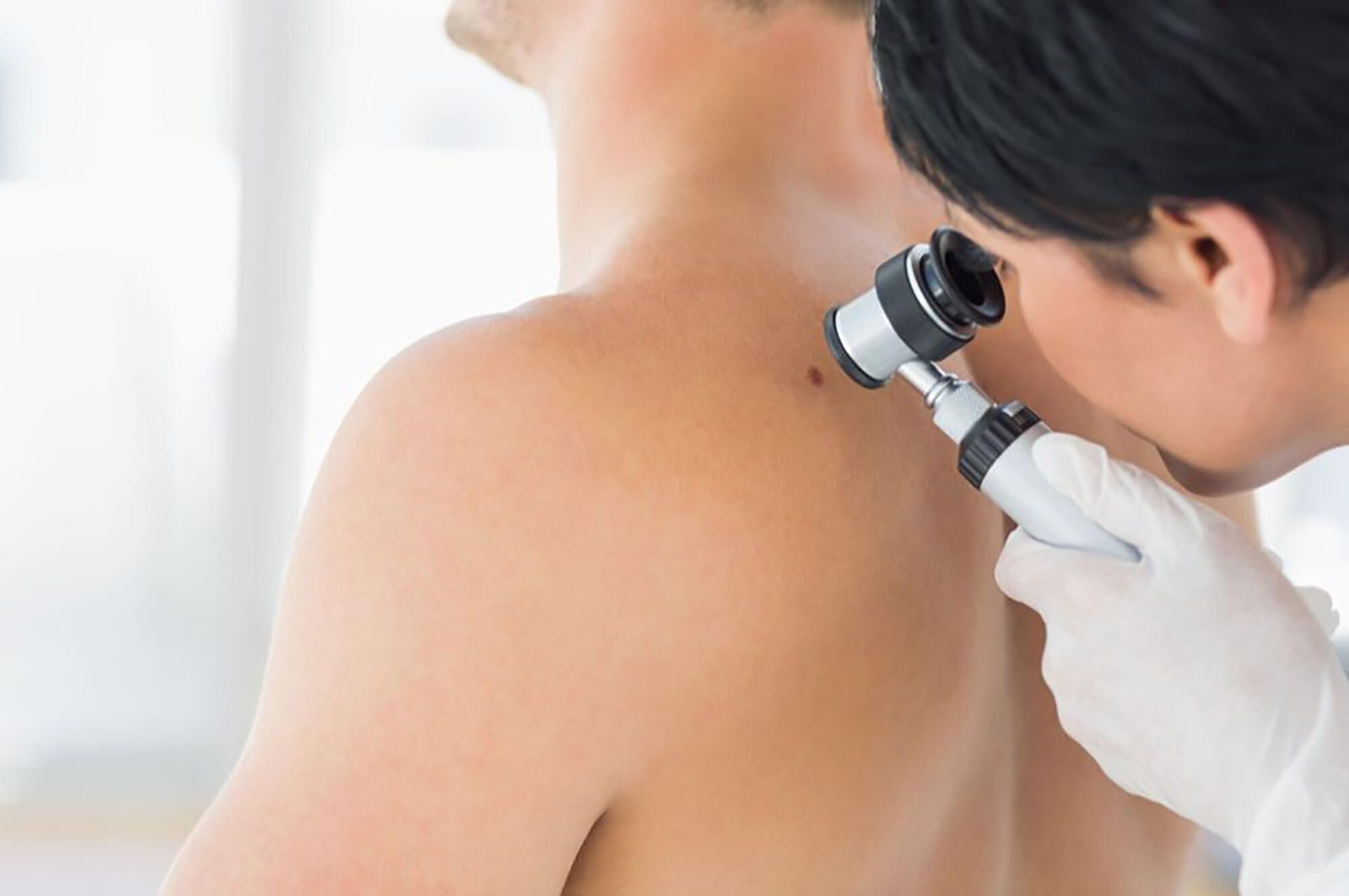 Professional Certificate of Advanced Dermatoscopy (Online)