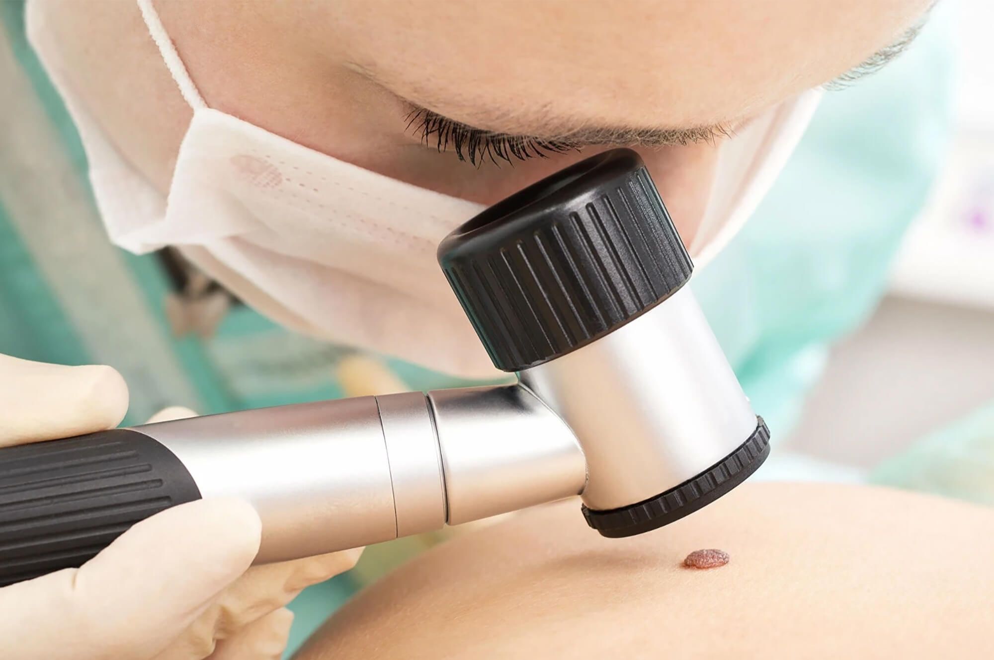 General Practice Fellowship Certificate of Advanced Dermatoscopy