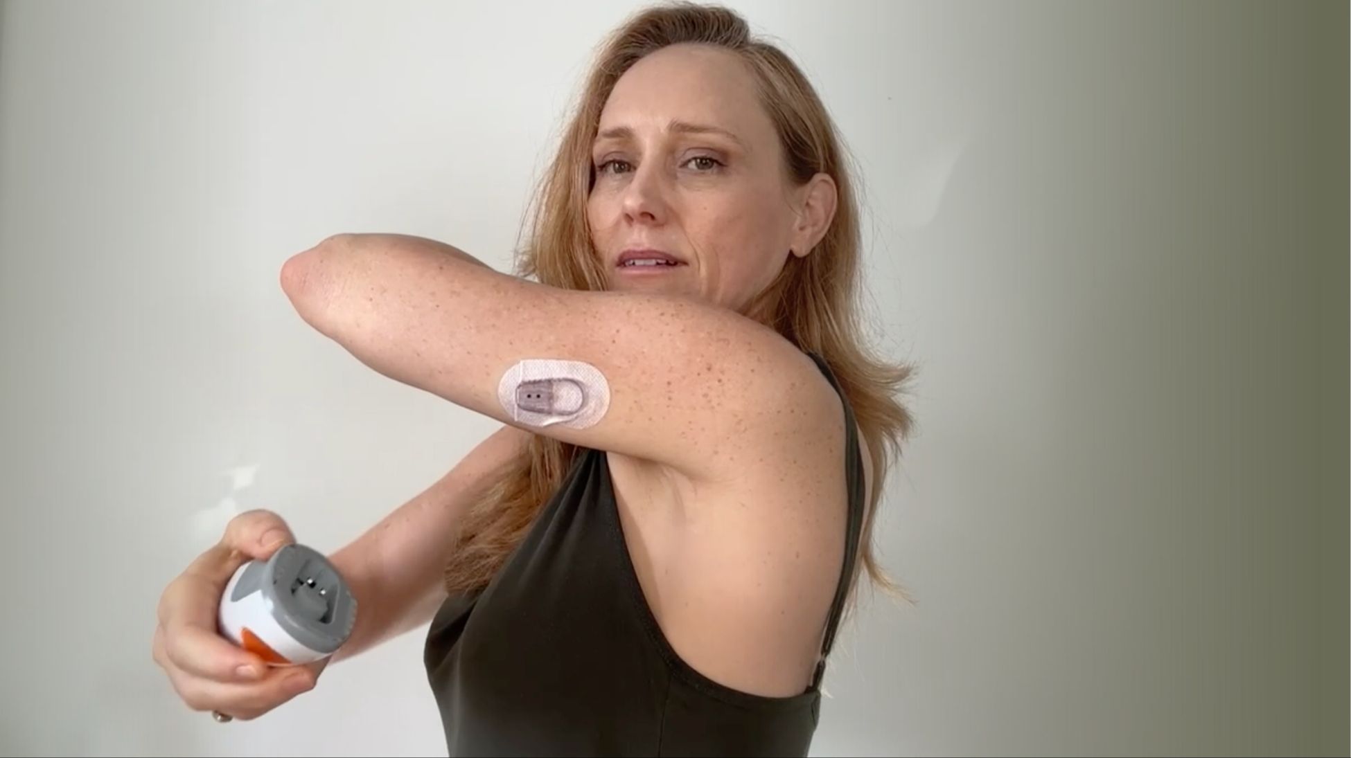 Woman wearing Continuous Glucose Monitor (CGM).